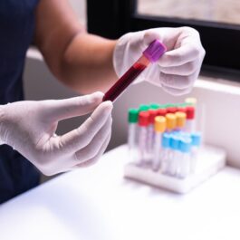 person holding a blood sample in a test tube