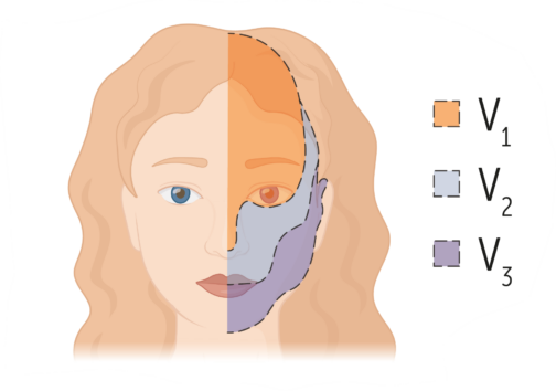 mymedschooltrigeminal-neuralgia